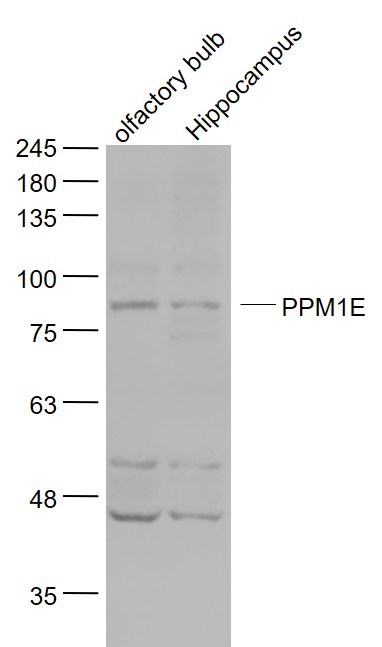 1 - PPM1E Rabbit pAb AP57851