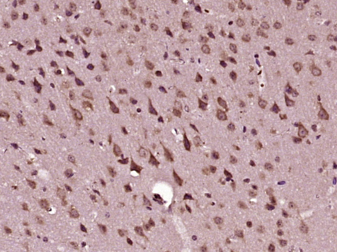 14 - PPM1E Rabbit pAb AP57851