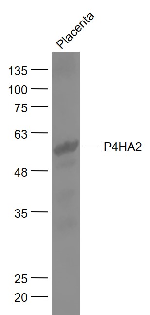 1 - P4HA2 Rabbit pAb AP57852