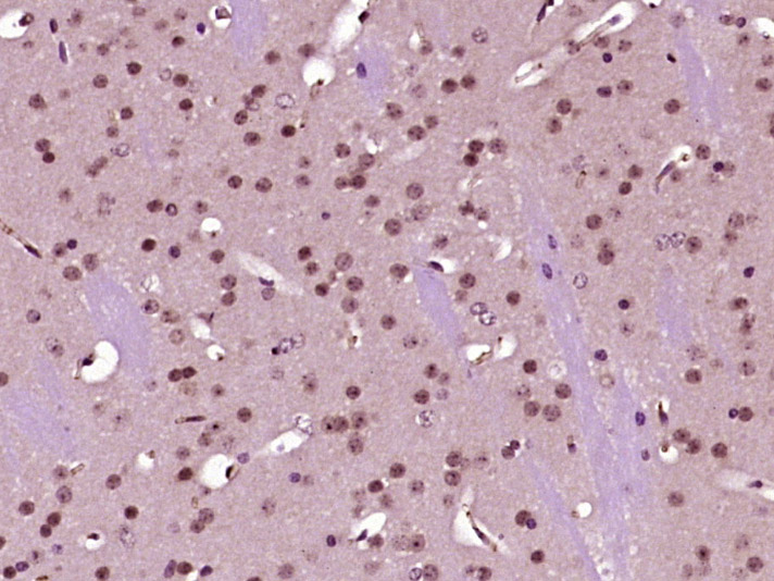 14 - p66 alpha/GATAD2A Rabbit pAb AP57853