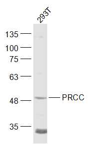 1 - PRCC/Papillary renal cell carcinoma Rabbit pAb AP57856