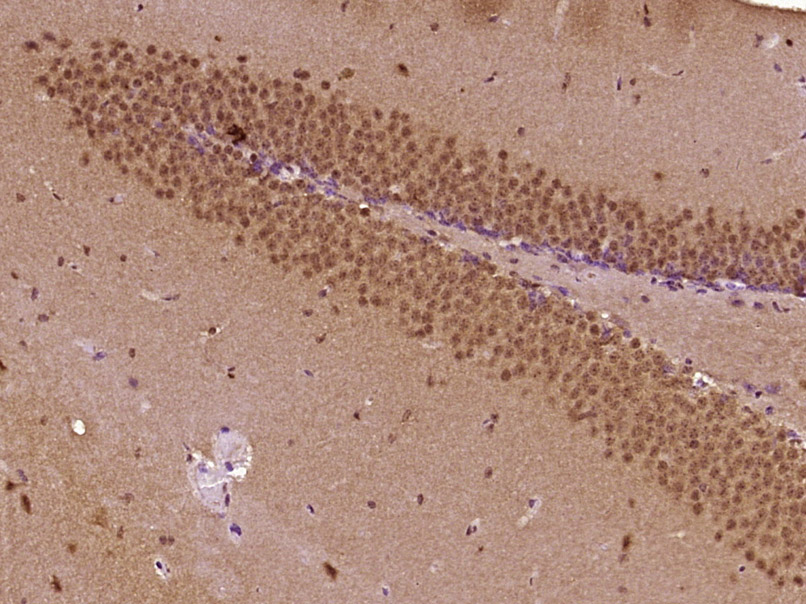 14 - PRCC/Papillary renal cell carcinoma Rabbit pAb AP57856