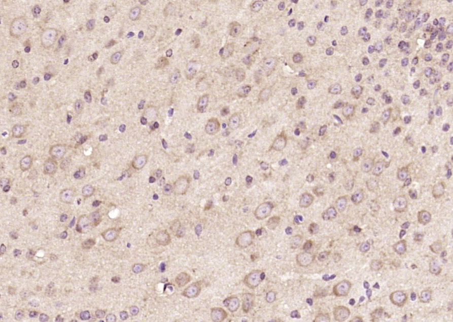 14 - OLFML1 Rabbit pAb AP57860