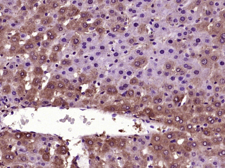 14 - RABIF Rabbit pAb AP57863