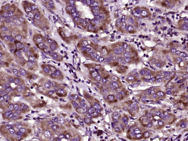 14 - OOSP1 Rabbit pAb AP57866
