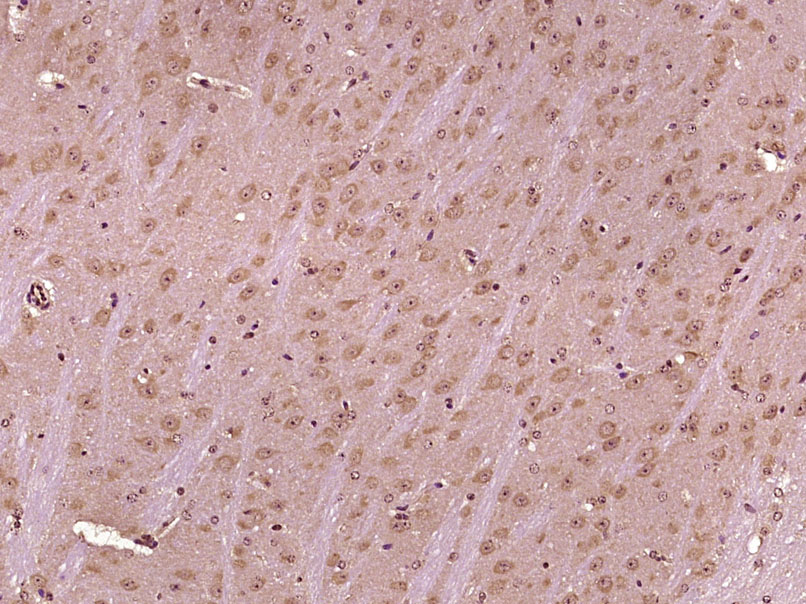14 - RALGAPB/p170 Rabbit pAb AP57901