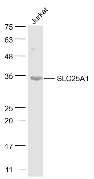 1 - SLC25A1 Rabbit pAb AP57930