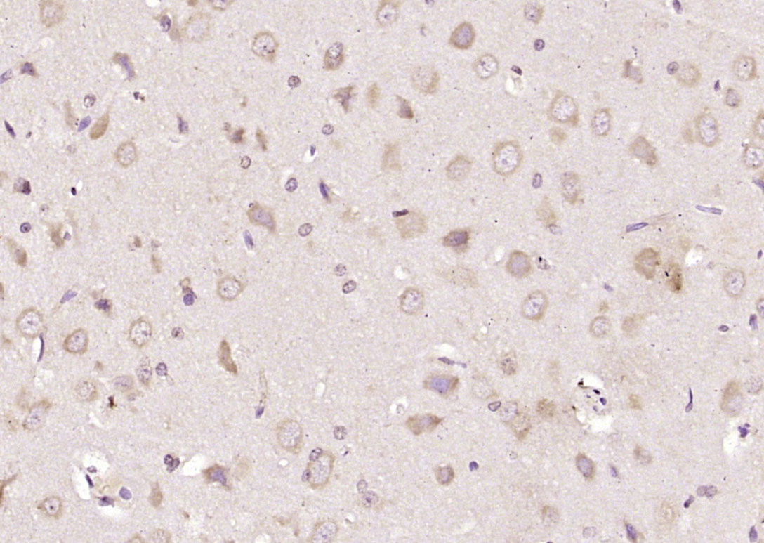 14 - SLC25A1 Rabbit pAb AP57930