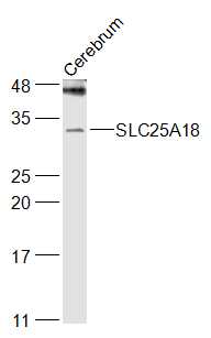 1 - SLC25A18 Rabbit pAb AP57931