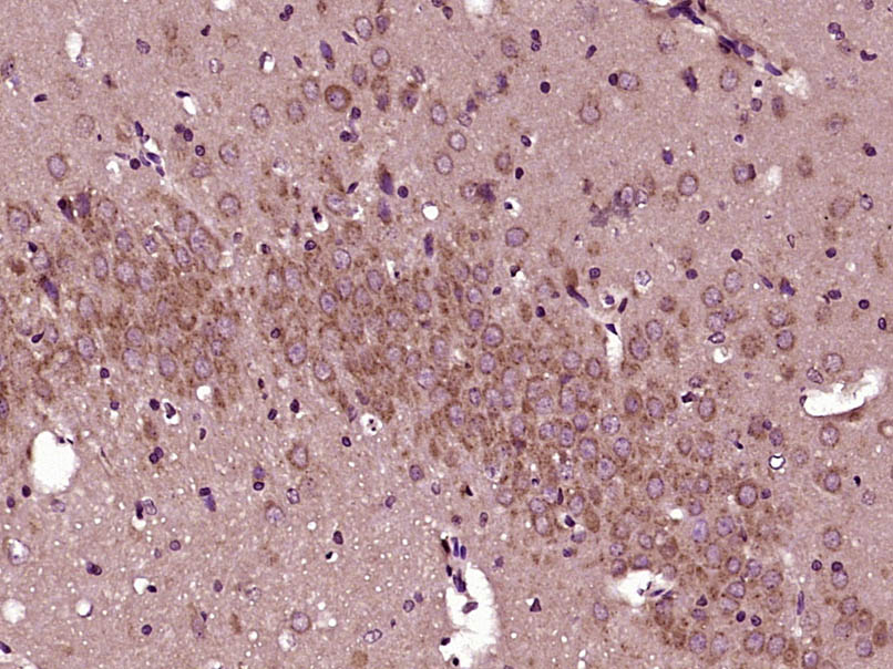 14 - SLC25A18 Rabbit pAb AP57931