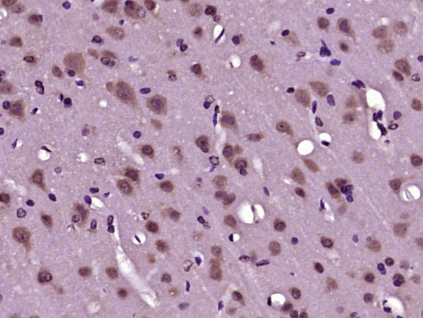 14 - SLC25A33 Rabbit pAb AP57937