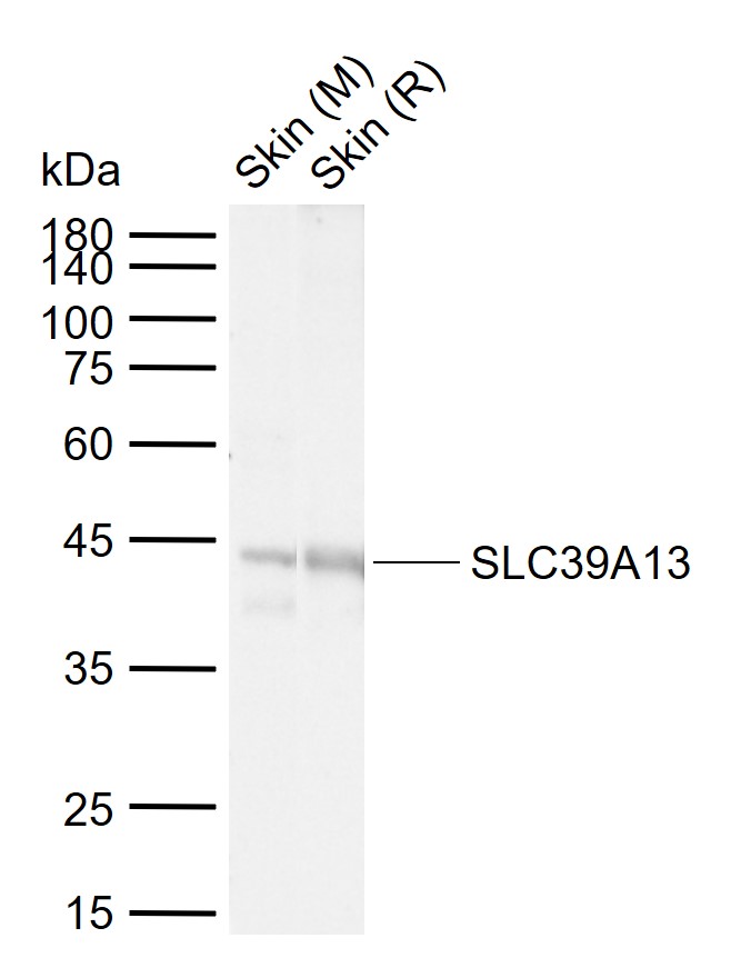 1 - SLC39A13 Rabbit pAb AP57961