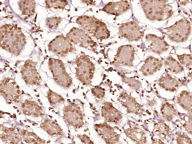 14 - RBM15B Rabbit pAb AP57963