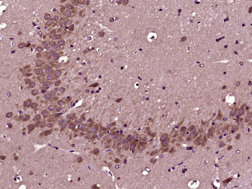 14 - RBM33 Rabbit pAb AP57965