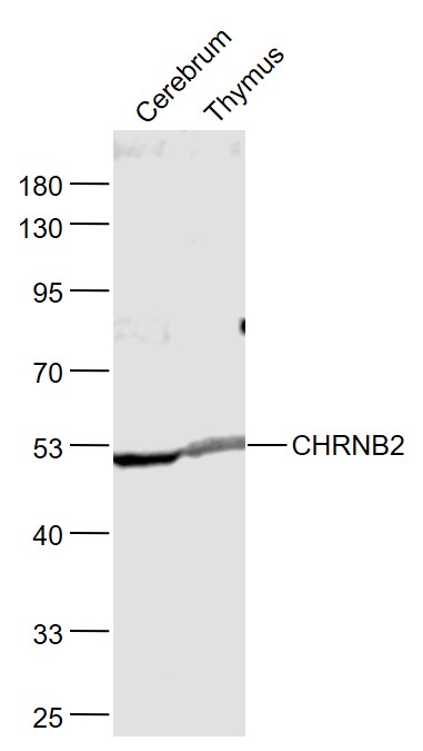 1 - CHRNB2 Rabbit pAb AP57972