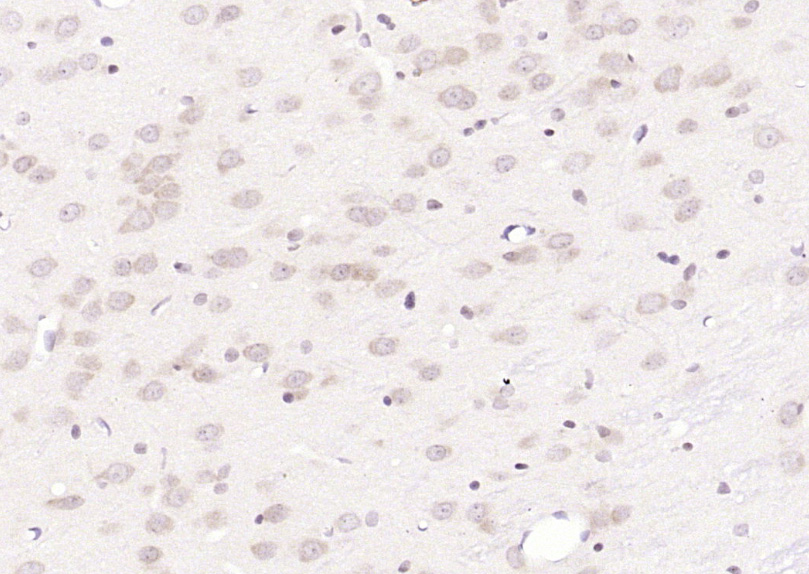 14 - CHRNB2 Rabbit pAb AP57972