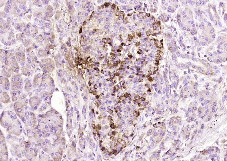 14 - SSTR4 Rabbit pAb AP57975
