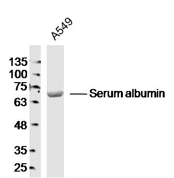 1 - Albumin Rabbit pAb AP57983