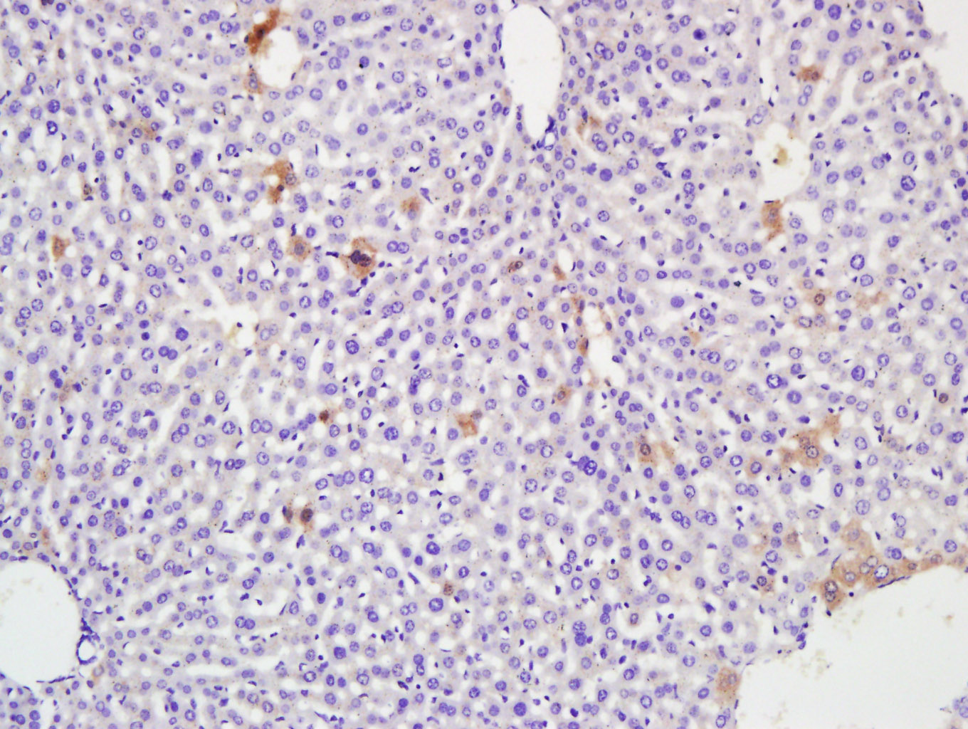 14 - Albumin Rabbit pAb AP57983