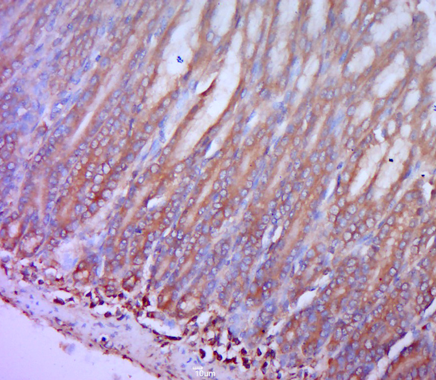 14 - CCR-2 Rabbit pAb AP57987