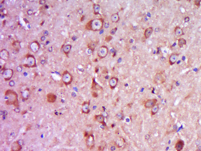 14 - ITSN2 Rabbit pAb AP57993