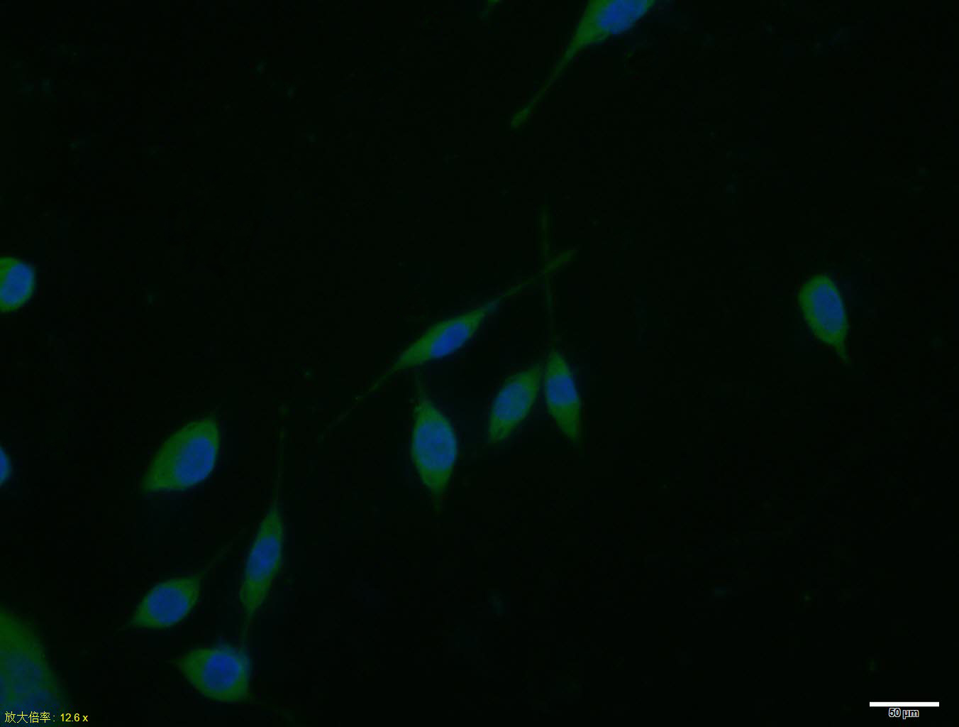 0 - Dystrobrevin alpha Rabbit pAb AP57995