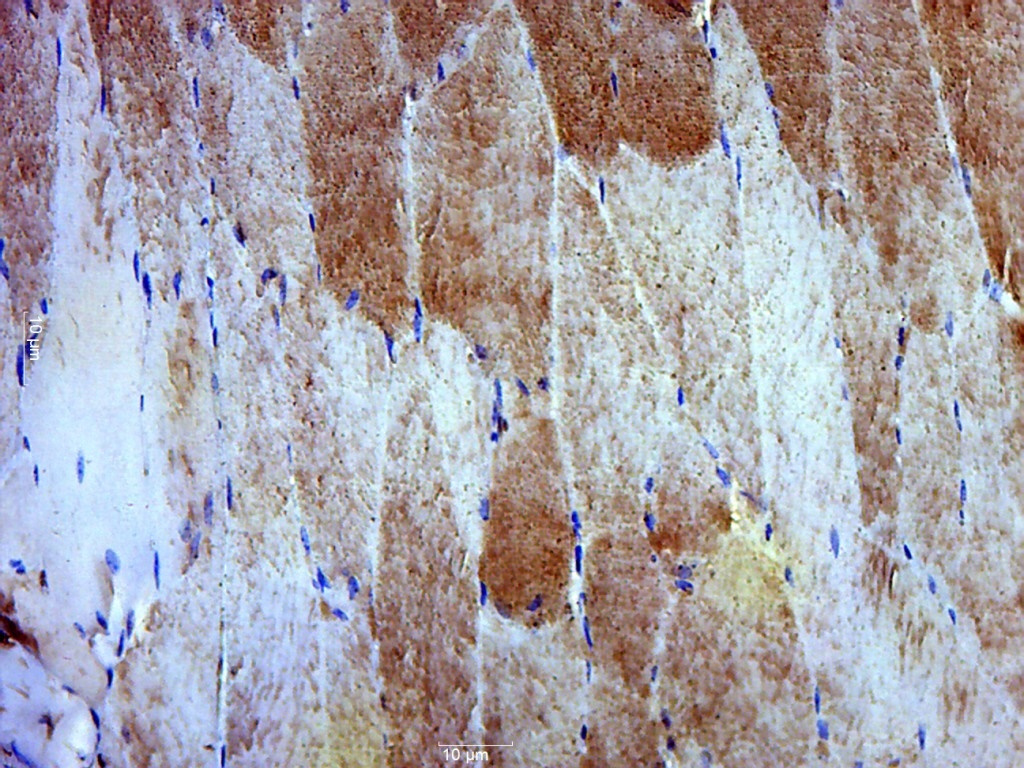 14 - Dystrobrevin alpha Rabbit pAb AP57995