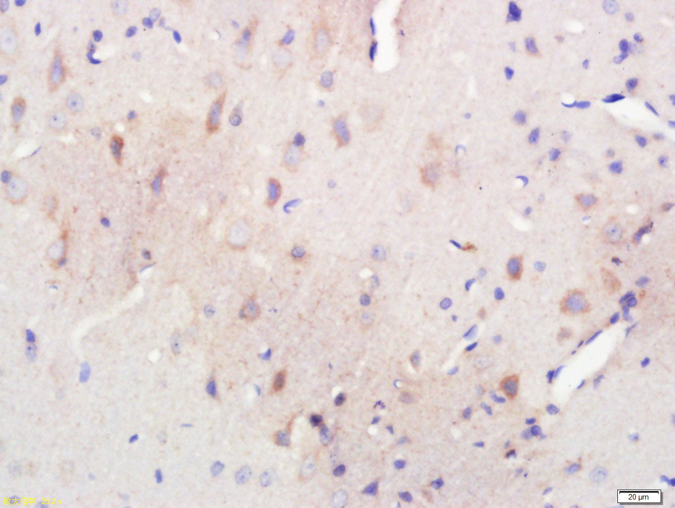 14 - Spindly Rabbit pAb AP57997