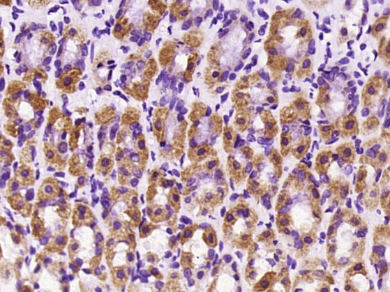 14 - KIF14 Rabbit pAb AP58031