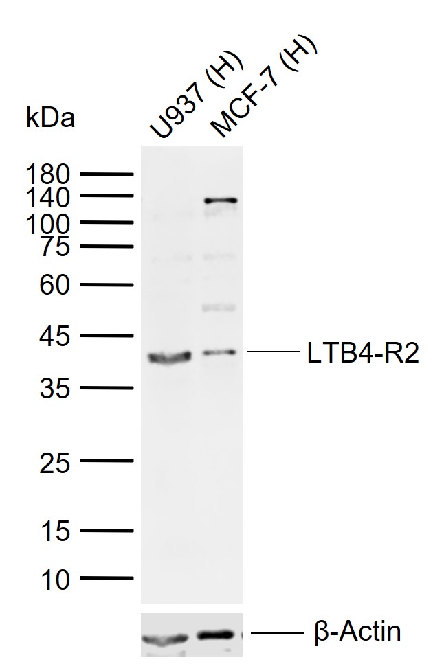1 - LTB4-R2 Rabbit pAb AP58043