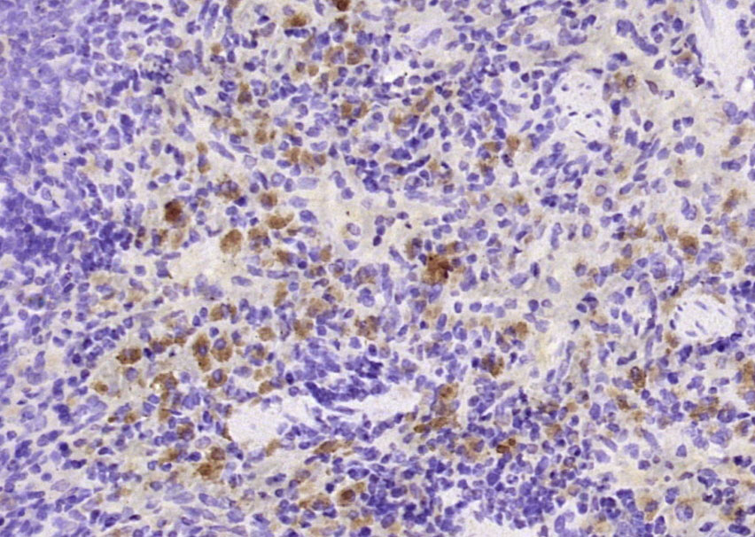 14 - MD1 Rabbit pAb AP58045