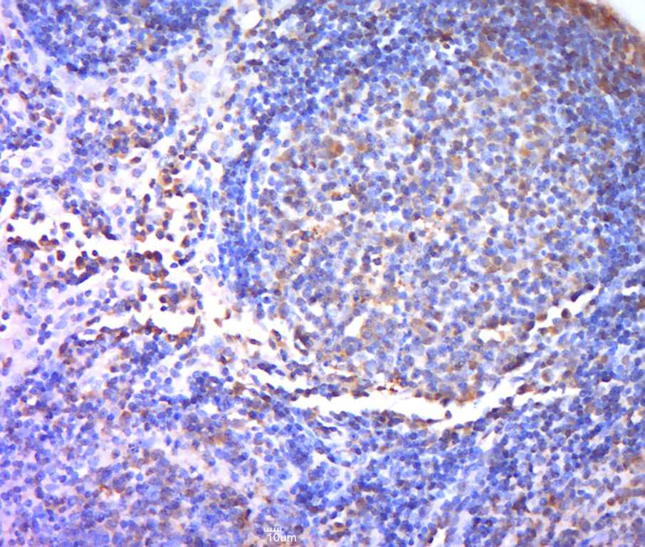 14 - TREML1 Rabbit pAb AP58053