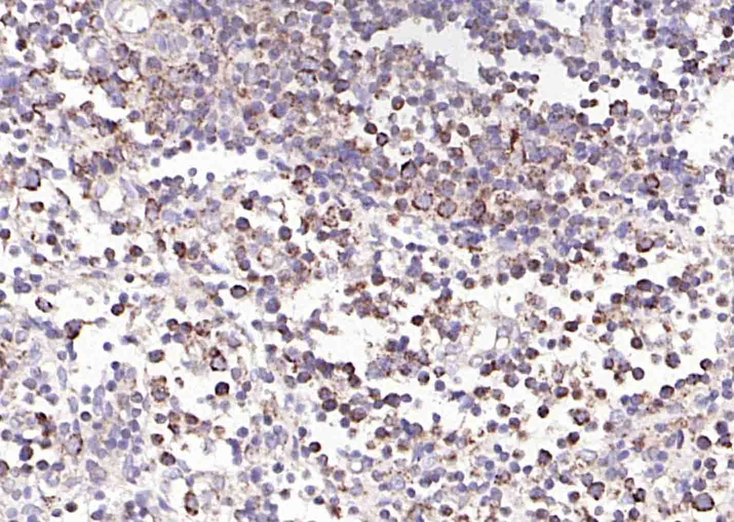 14 - ULBP1 Rabbit pAb AP58054