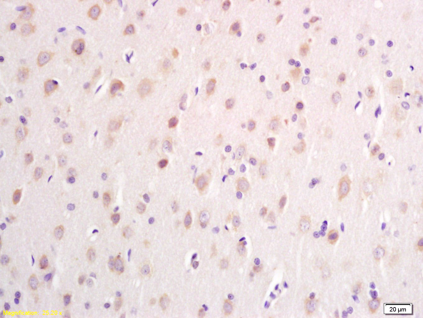 14 - DTNB Rabbit pAb AP58075