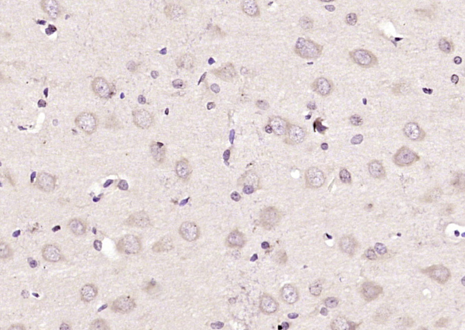14 - MEG1 Rabbit pAb AP58081