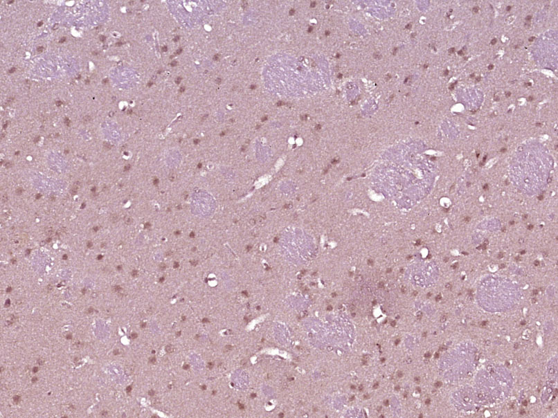 14 - PLASTIN3 Rabbit pAb AP58083