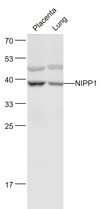 1 - NIPP1 Rabbit pAb AP58086