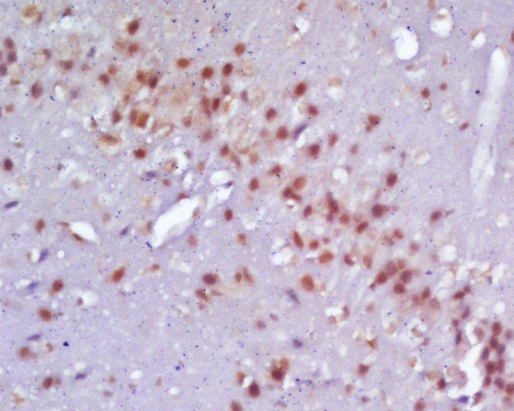 14 - Neurogenin 2 Rabbit pAb AP58092