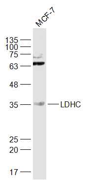 1 - LDHC Rabbit pAb AP58095