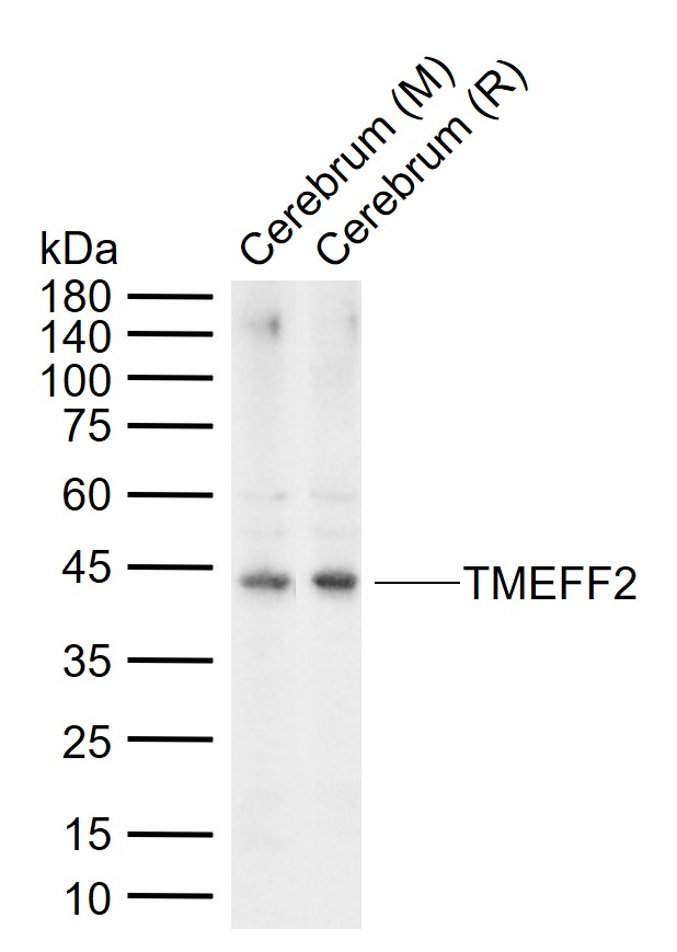 1 - TMEFF2 Rabbit pAb AP58099