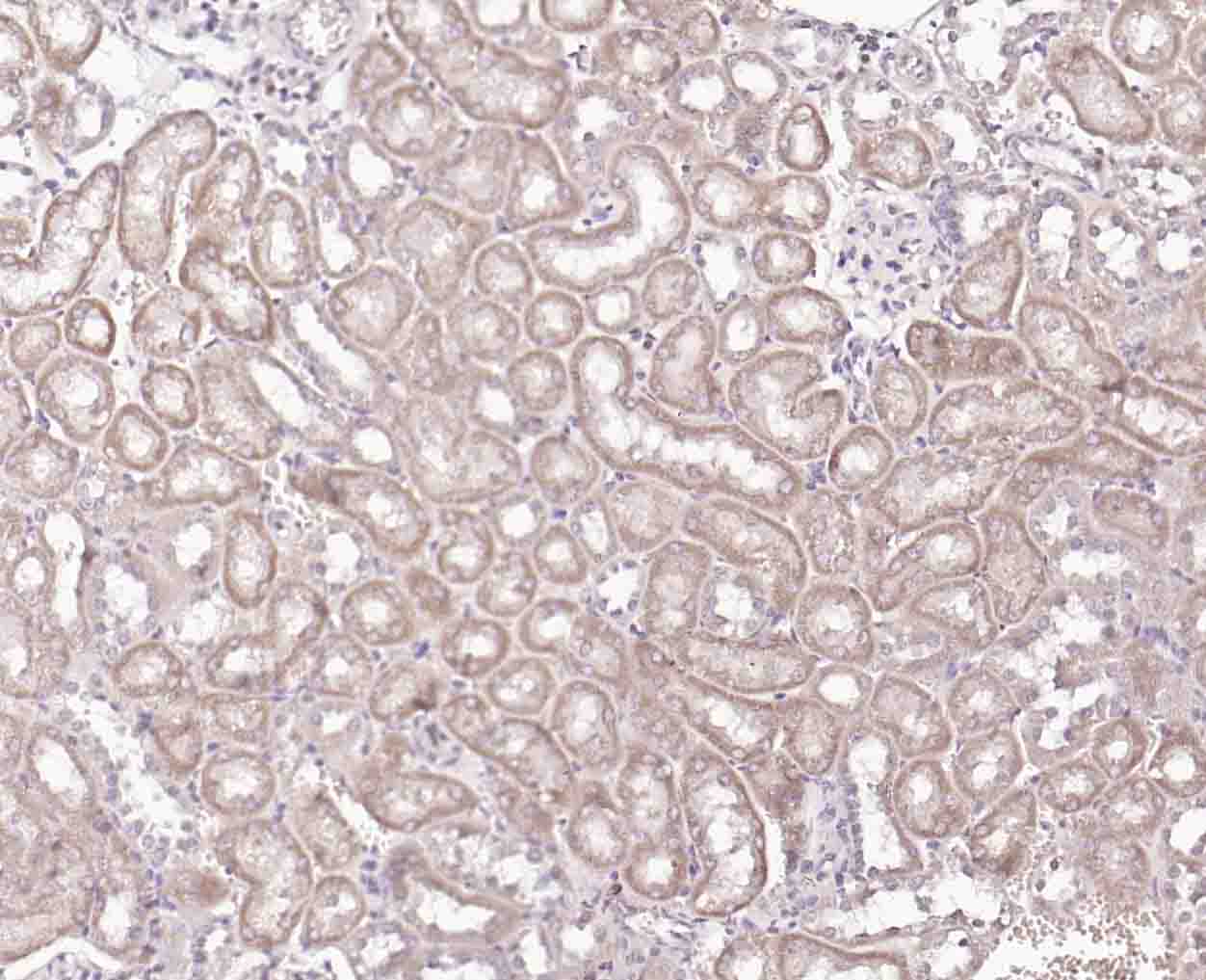 14 - TMEFF2 Rabbit pAb AP58099