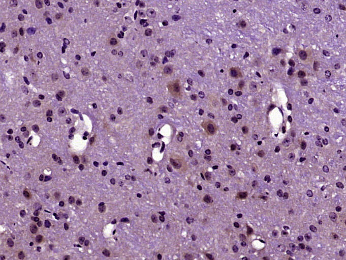 14 - Rab24 Rabbit pAb AP58104