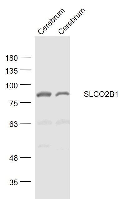 1 - SLCO2B1 Rabbit pAb AP58108