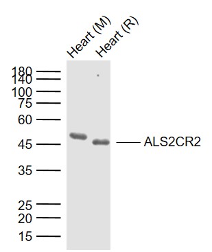 1 - ALS2CR2 Rabbit pAb AP58110