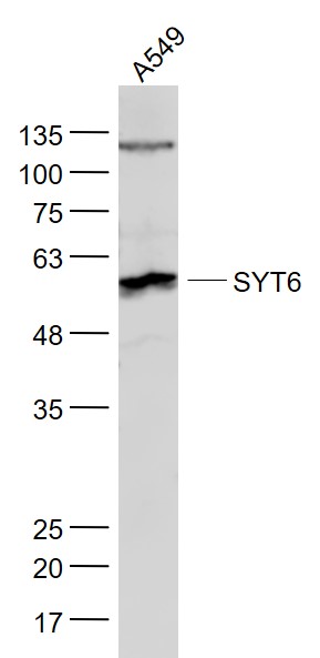 1 - SYT6 Rabbit pAb AP58128