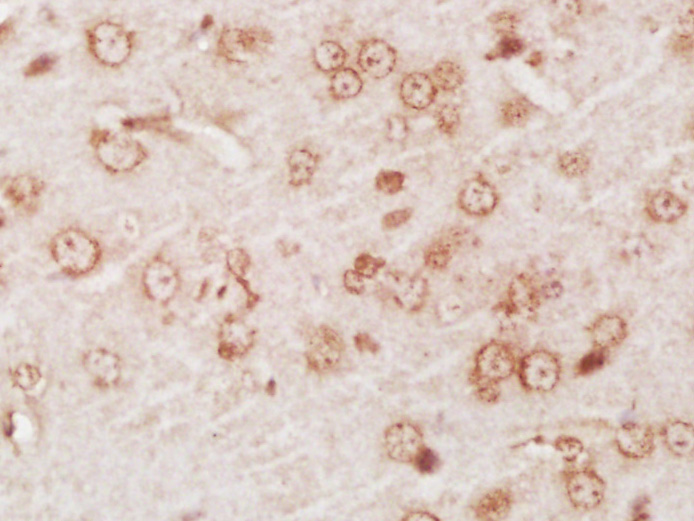14 - SYT6 Rabbit pAb AP58128