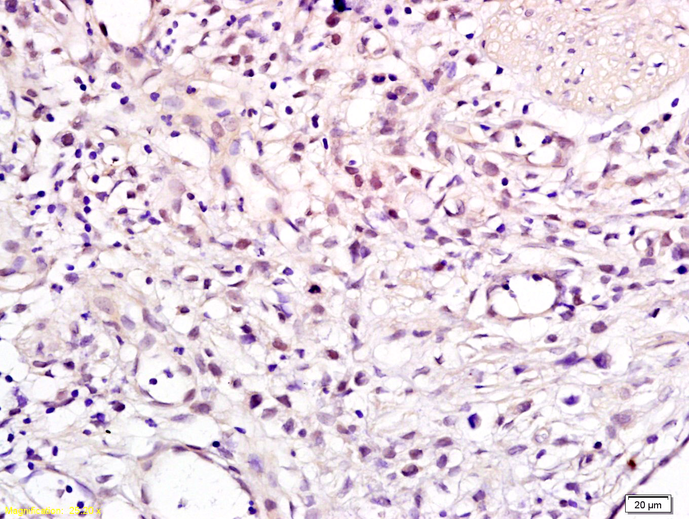 14 - CHMP1A Rabbit pAb AP58133