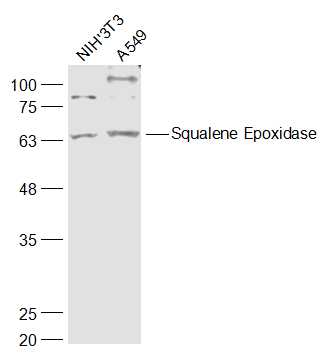 1 - Squalene Epoxidase Rabbit pAb AP58135