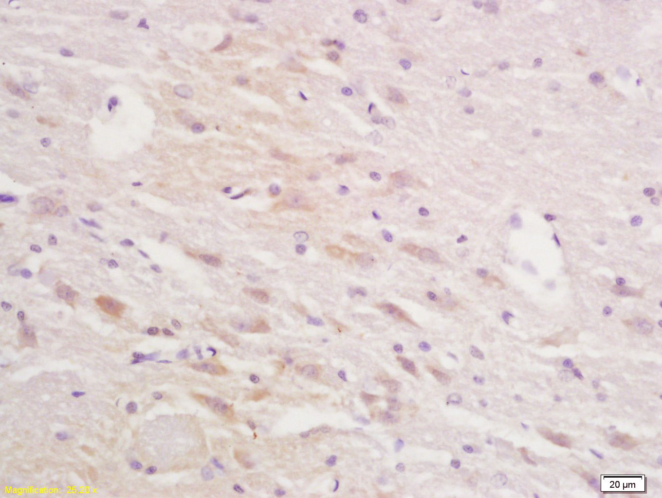 14 - Squalene Epoxidase Rabbit pAb AP58135