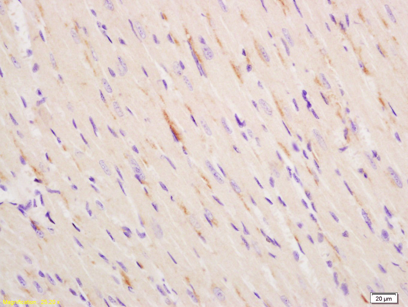 14 - ITPR2 Rabbit pAb AP58137
